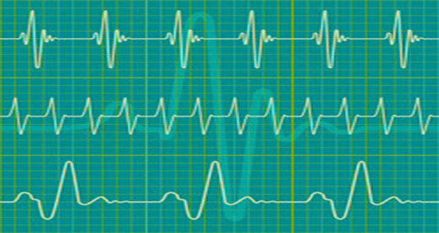 Analyse de Fourier et images